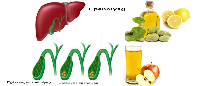 almalevel-epeko-ellen